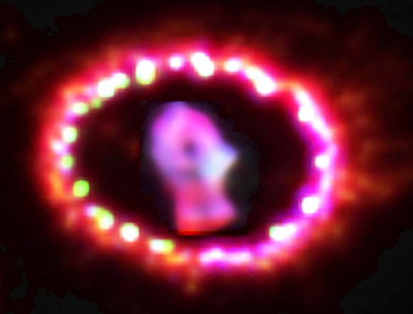 SN1987A
