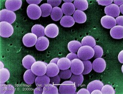 780px-Staphylococcus_aureus_VISA_2
